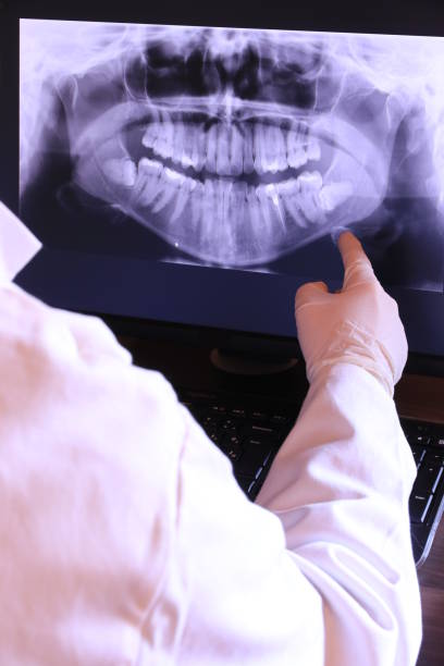 Best Emergency Dental Care for Broken or Chipped Teeth in Parma, ID
