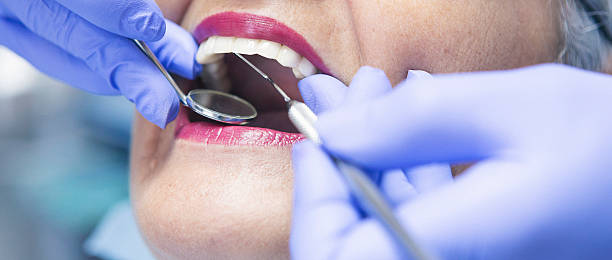 Best Urgent Care for Lost Fillings or Crowns in Parma, ID